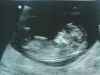 baby_12_weeks